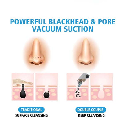 PurePore Pro: Precision Blackhead Suction Device